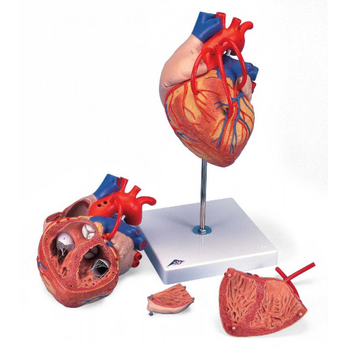 Модель сердца, 2-кратное увеличение, 4 части