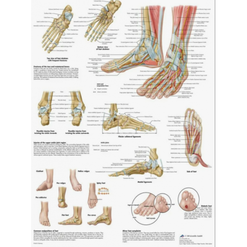 Плакат медицинский Стопа и суставы стопы, анатомия и патология
