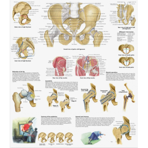 Плакат медицинский Таз и тазобедренный сустав, анатомия и патология