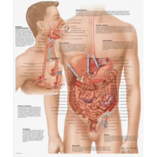 Плакат медицинский Заболевания пищеварительной системы