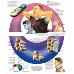 Плакат медицинский Травма ускорения шейного отдела позвоночника
