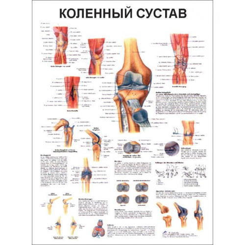 Плакат медицинский Коленный сустав