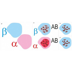 Модель-аппликация "Переливание крови. Определение группы крови"